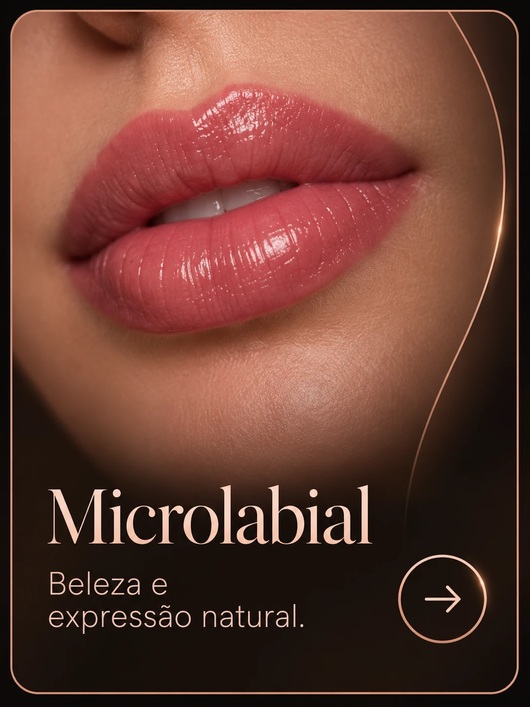 Microlabial — beleza e expressão natural